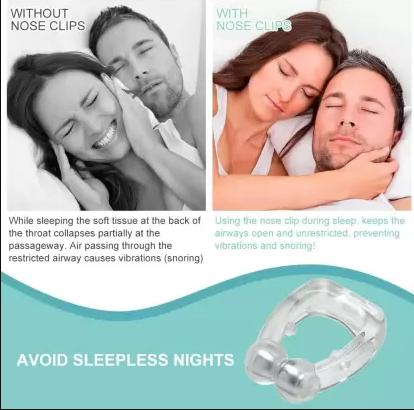 ANTI SNORING DEVICE