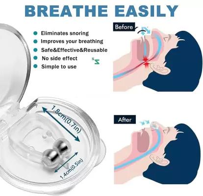 ANTI SNORING DEVICE